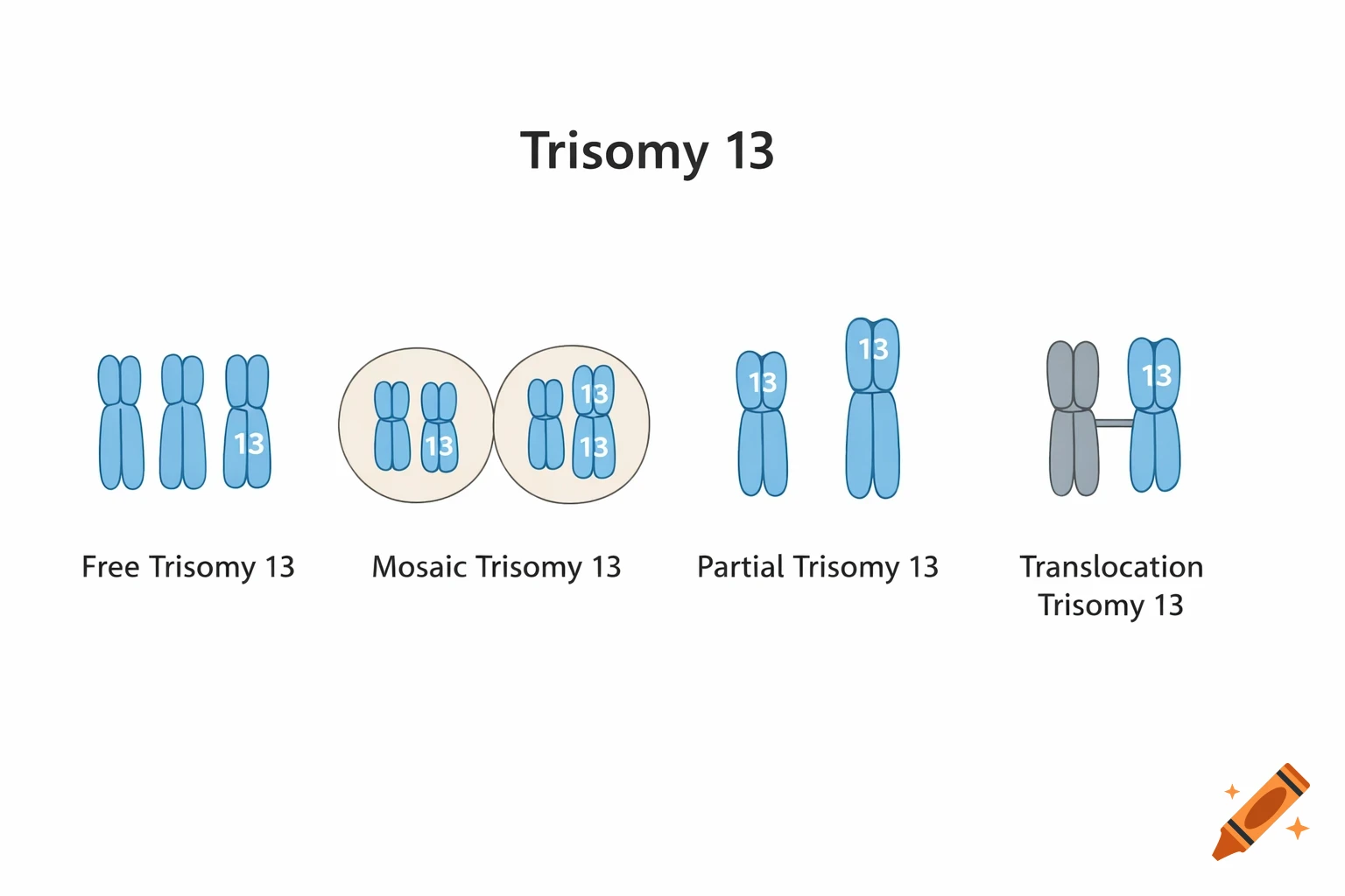 Diagram illustrating four types of Trisomy 13: Free, Mosaic, Partial, and Translocation, with labeled chromosomes.