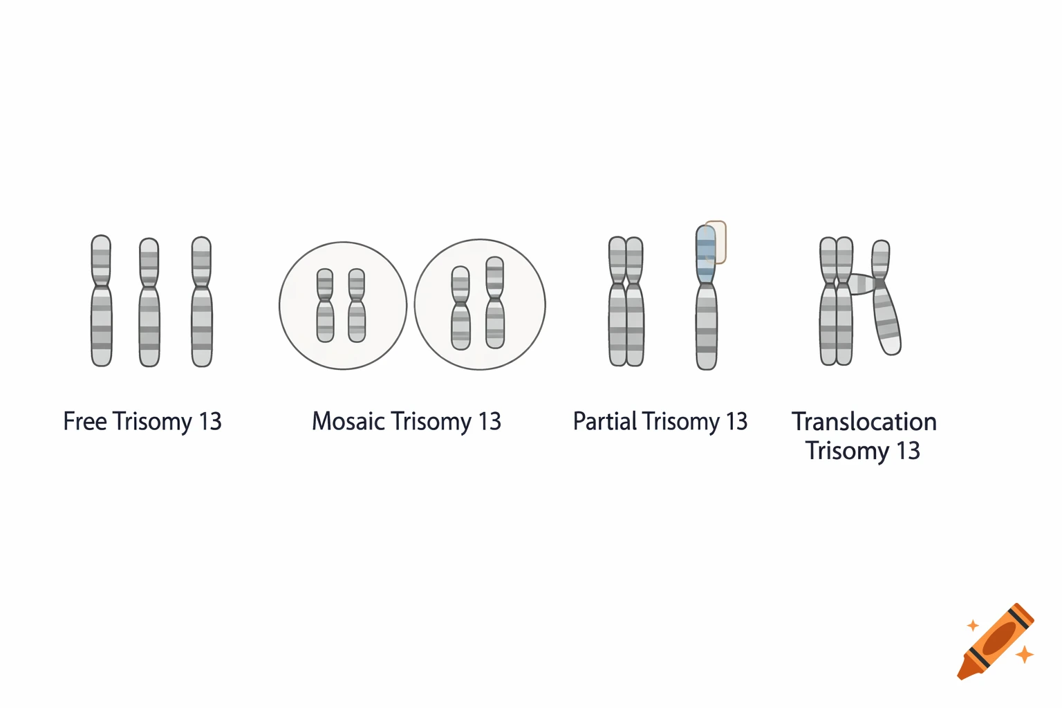Diagram illustrating four types of Trisomy 13: Free, Mosaic, Partial, and Translocation, with chromosome visuals.