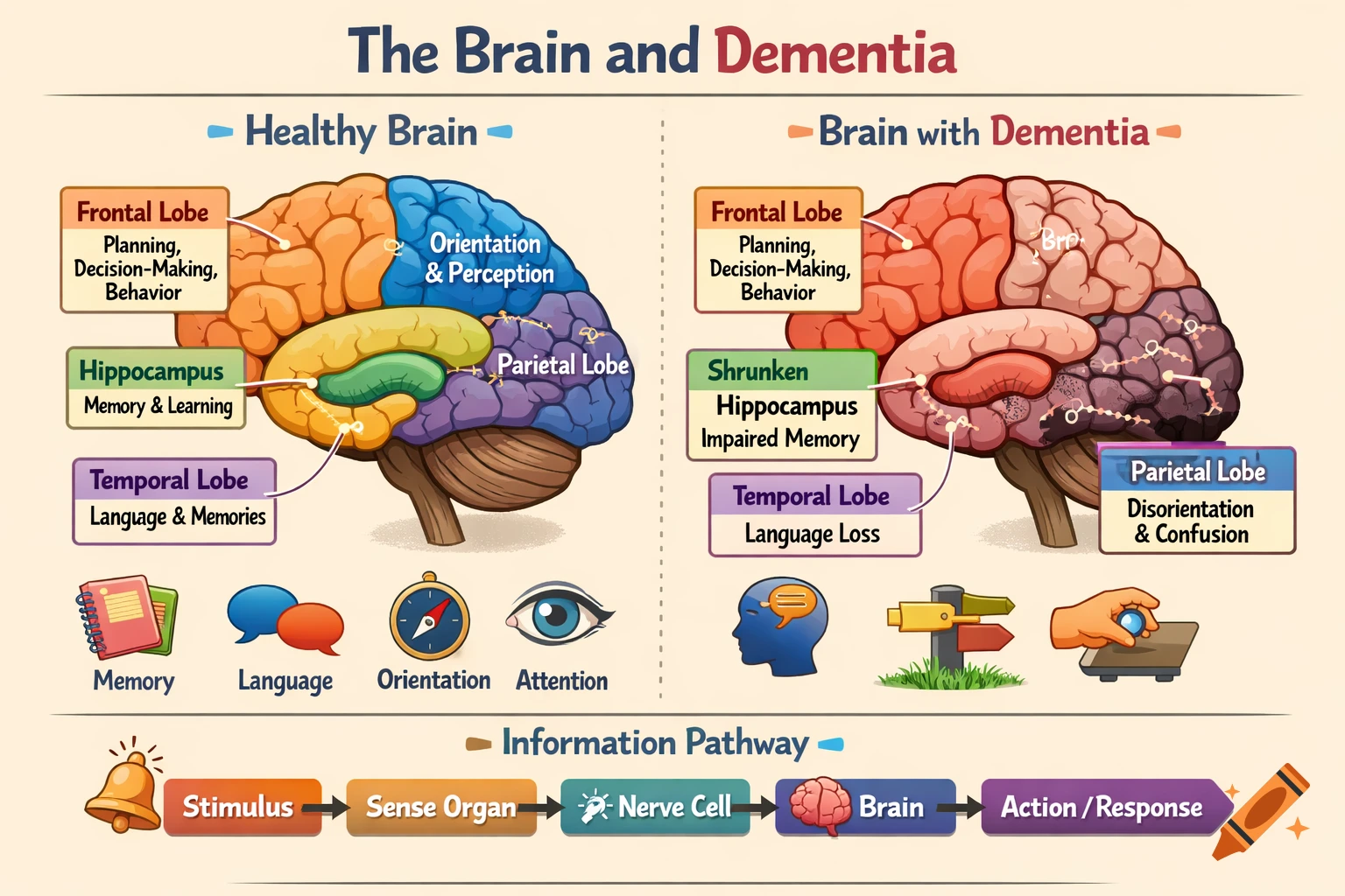 An infographic illustrating a healthy brain vs. a brain with dementia, showing brain regions, functions, and an information pathway.