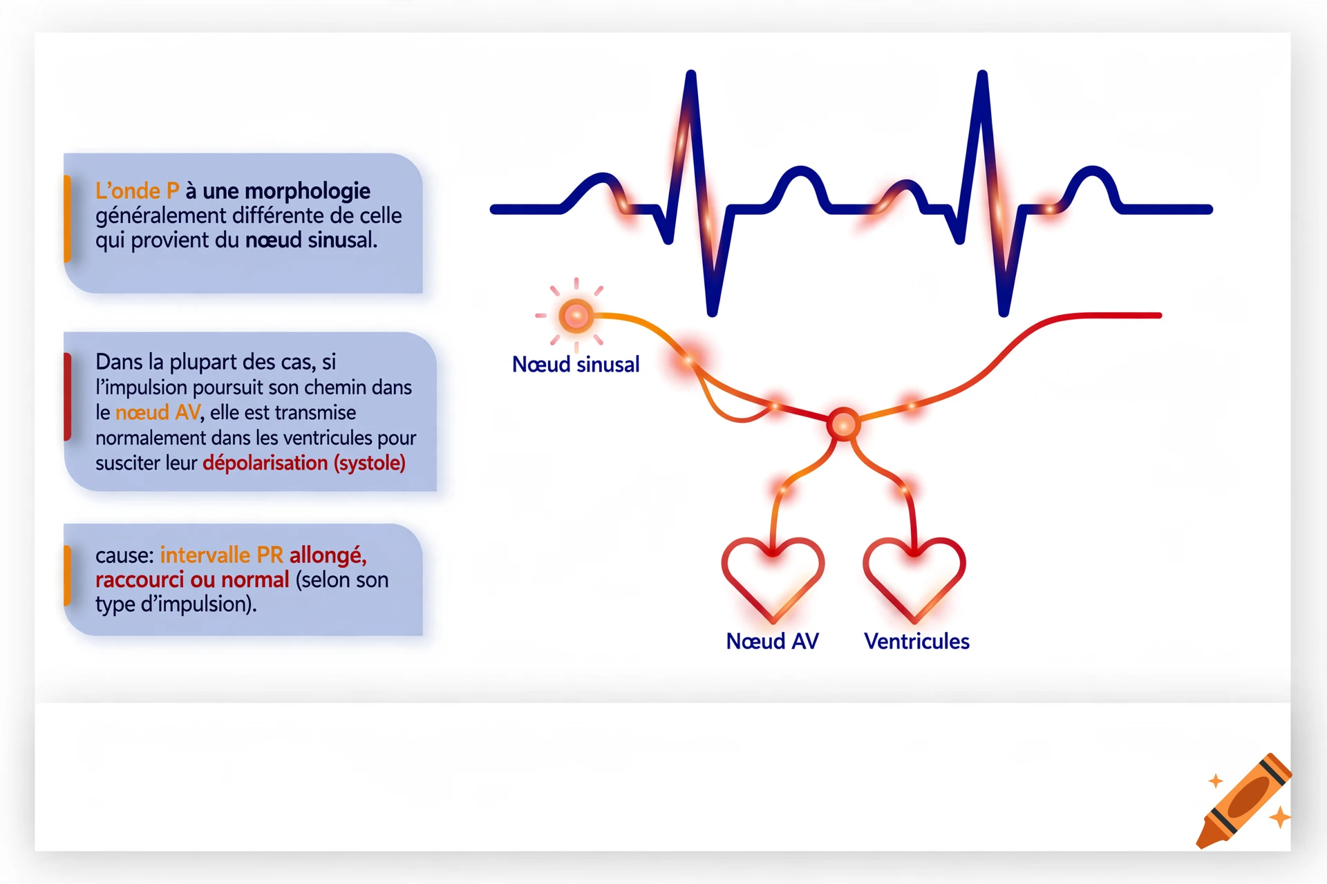 Medical diagram illustrating cardiac electrical conduction with french text and ECG wave.