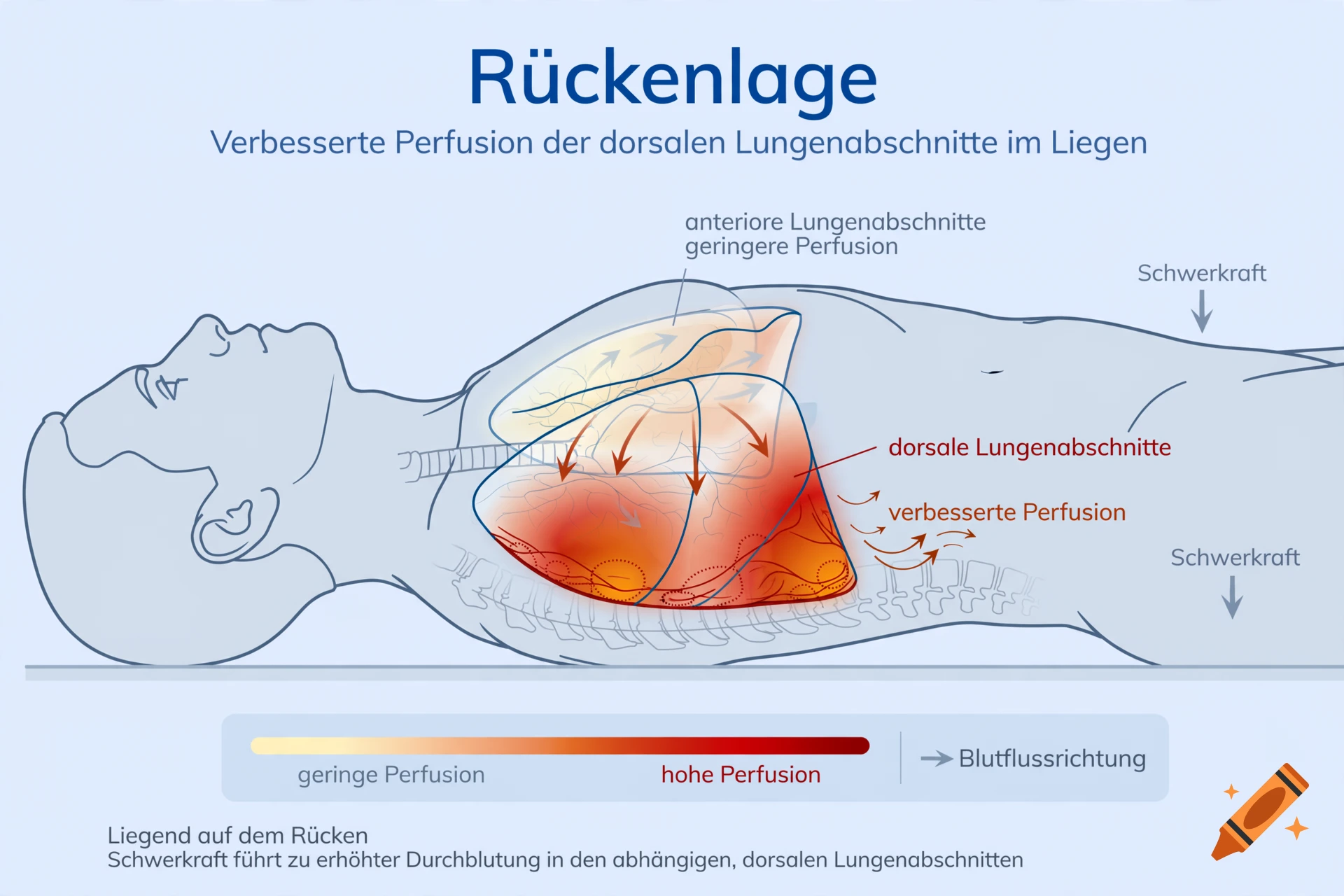 Medical diagram showing lung perfusion in the supine position in German.
